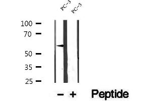 Western blot analysis of extracts of PC-3 cells, using ETV5 antibody.
