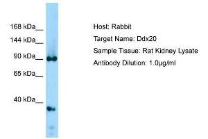 Host: Rabbit  Target Name: Ddx20  Sample Tissue: Rat Kidney lysates  Antibody Dilution: 1. (DDX20 antibody  (Middle Region))