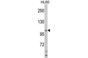 Western blot analysis of HIP116A Antibody (Center) in HL60 cell line lysates (35 µg/lane).
