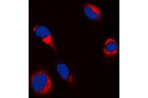 Immunofluorescence (IF) image for anti-Tyrosinase (TYR) (C-Term) antibody (ABIN7297216)