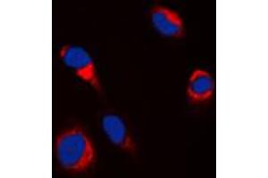 Immunofluorescent analysis of Tyrosinase staining in HepG2 cells. (TYR antibody  (C-Term))
