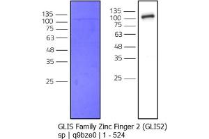 Western Blotting (WB) image for GLIS Family Zinc Finger 2 (GLIS2) (AA 1-524) protein (Strep Tag) (ABIN3117905) (GLIS2 Protein (AA 1-524) (Strep Tag))