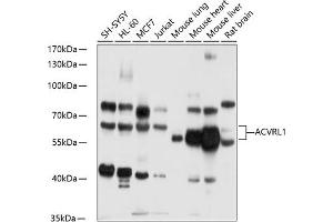 Western blot analysis of extracts of various cell lines, using  antibody (ABIN6129872, ABIN6136507, ABIN6136508 and ABIN6218899) at 1:1000 dilution. (ACVRL1 antibody)