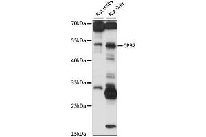 Western blot analysis of extracts of various cell lines, using CPB2 antibody (ABIN6293650) at 1:1000 dilution.