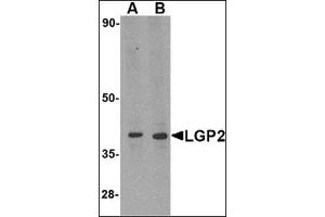 Western blot analysis of LGP2 in MDA-MB-361 cell lysate with this product at (A) 0. (DHX58 antibody  (N-Term))