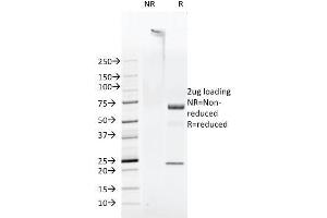 SDS-PAGE Analysis Purified FAT Mouse Monoclonal Antibody (FAT1-3D7/1). (FAT1 antibody  (Cytoplasmic Domain))