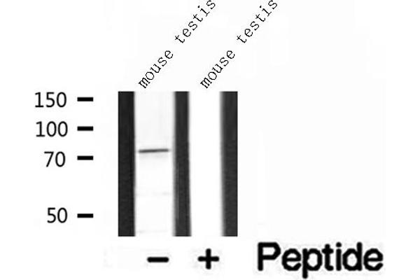 BBS2 antibody  (C-Term)