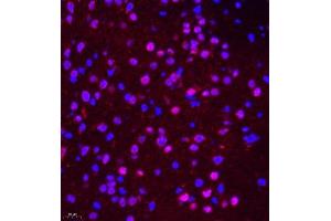 Immunofluorescence of paraffin embedded mouse brain using NSFL1C (ABIN7074865) at dilution of 1:650 (400x lens) (NSFL1C antibody)