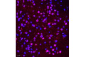 Immunofluorescence of paraffin embedded mouse brain using NSFL1C (ABIN7074865) at dilution of 1:650 (400x lens) (NSFL1C antibody)
