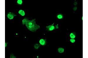 Image no. 3 for anti-T-Cell Acute Lymphocytic Leukemia 1 (TAL1) antibody (ABIN1501294)