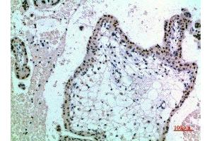 Immunohistochemical analysis of paraffin-embedded human-placenta, antibody was diluted at 1:200 (NOP56 antibody  (AA 191-240))