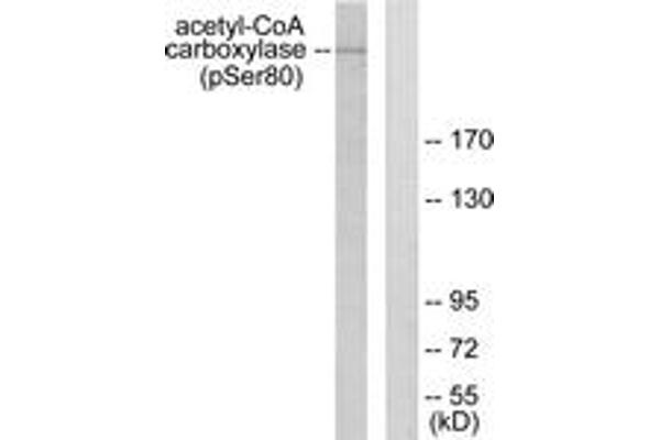 Acetyl-CoA Carboxylase anticorps  (pSer80)