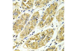 Immunohistochemistry of paraffin-embedded Human gastric using ARHGAP25 antibody at dilution of 1:100 (x400 lens). (ARHGAP25 antibody  (AA 1-370))