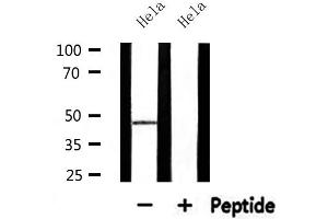 Western blot analysis of extracts from Hela, using ABHD8 Antibody. (ABHD8 antibody  (Internal Region))