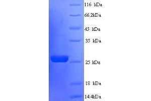 SDS-PAGE (SDS) image for Suppressor of Cytokine Signaling 3 (SOCS3) (AA 1-225), (full length) protein (His tag) (ABIN5713856) (SOCS3 Protein (AA 1-225, full length) (His tag))