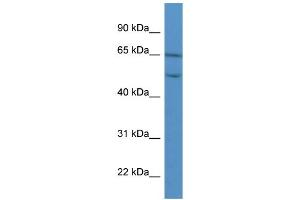 WB Suggested Anti-COL8A2 Antibody Titration: 0. (COL8a2 antibody  (C-Term))