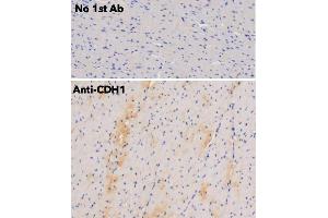 Immunohistochemistry (IHC) image for anti-Cadherin 1, Type 1, E-Cadherin (Epithelial) (CDH1) antibody (ABIN6254215)