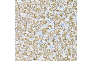 Immunohistochemistry of paraffin-embedded rat ovary using THUMPD3 Rabbit pAb (ABIN6132951, ABIN6149133, ABIN6149134 and ABIN6214652) at dilution of 1:200 (40x lens). (THUMPD3 antibody  (AA 1-250))