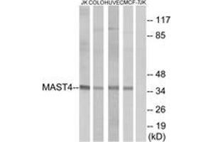 Western blot analysis of extracts from Jurkat/COLO/HuvEc/MCF-7 cells, using MAST4 Antibody. (MAST4 antibody  (AA 251-300))