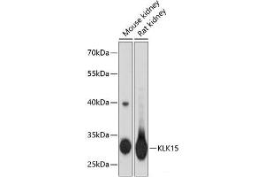 Western blot analysis of extracts of various cell lines using KLK15 Polyclonal Antibody at dilution of 1:3000. (Kallikrein 15 antibody)