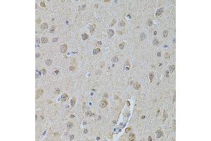 Immunohistochemistry of paraffin-embedded mouse brain using NME1 Antibody. (NME1 antibody  (C-Term))