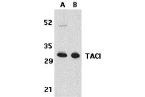 Western Blotting (WB) image for anti-Tumor Necrosis Factor Receptor Superfamily, Member 13B (TNFRSF13B) (N-Term) antibody (ABIN1031600)