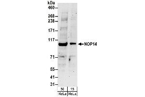 Western Blotting (WB) image for anti-NOP14 Nucleolar Protein (Nop14) (AA 750-800) antibody (ABIN7453145) (Nop14 antibody  (AA 750-800))
