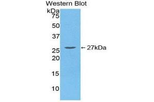 Western Blotting (WB) image for anti-Transforming Growth Factor, beta-Induced, 68kDa (TGFBI) (AA 423-632) antibody (ABIN1860733)