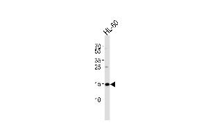 UBE2L6 antibody  (N-Term)