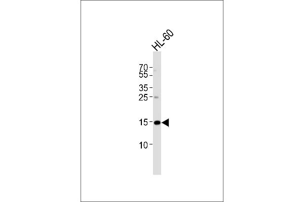 UBE2L6 anticorps  (N-Term)
