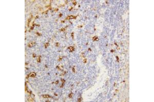 Anti-Alpha Amylase 1 antibody, IHC(P) IHC(P): Rat Spleen Tissue (AMY1A antibody  (N-Term))