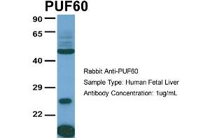 Host:  Rabbit  Target Name:  PUF60  Sample Type:  Human Fetal Liver  Antibody Dilution:  1. (PUF60 antibody  (C-Term))