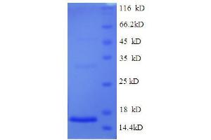 SDS-PAGE (SDS) image for Bone Morphogenetic Protein 3 (BMP3) (AA 363-472) protein (His tag) (ABIN5709143)