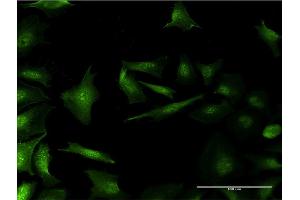 Immunofluorescence of monoclonal antibody to RP2 on HeLa cell.