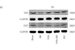VNS regulated the levels of glutathione and upregulated protein and mRNA levels of glutathione synthetase and glutathione S-transferase. (GST antibody)