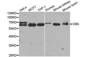 Western blot analysis of extracts of various cell lines, using CBS antibody.