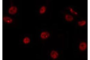 ABIN6266772 staining HepG2 by IF/ICC. (RBAK antibody  (N-Term))