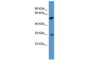 WB Suggested Anti-CABP4 Antibody Titration: 0. (CABP4 antibody  (N-Term))