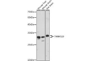 Western blot analysis of extracts of various cell lines, using TMEM119 antibody (ABIN7270953) at 1:1000 dilution. (TMEM119 antibody)