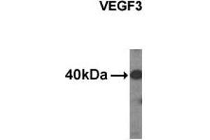 Western Blotting (WB) image for anti-Vascular Endothelial Growth Factor C (VEGFC) (C-Term), (N-Term) antibody (ABIN356356)