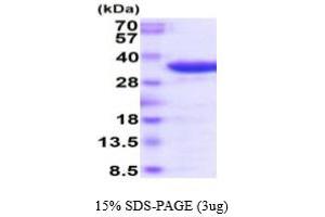 SDS-PAGE (SDS) image for Acid Phosphatase 5, Tartrate Resistant (ACP5) (AA 22-325) (Active) protein (ABIN6387961)