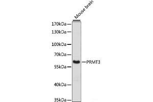 Western blot analysis of extracts of Mouse brain using PRMT3 Polyclonal Antibody at dilution of 1:3000. (PRMT3 antibody)
