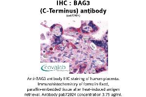Image no. 3 for anti-BCL2-Associated Athanogene 3 (BAG3) (C-Term) antibody (ABIN1732194) (BAG3 antibody  (C-Term))