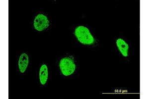Immunofluorescence of monoclonal antibody to ANKRD17 on HeLa cell.