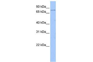 WB Suggested Anti-FOXM1 Antibody Titration:  1 ug/ml  Positive Control:  Jurkat cell lysate (FOXM1 antibody  (Middle Region))