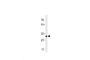 DANREhoxb8b Antibody (C-term) Azb10013a western blot analysis in zebra fish brain tissue lysates (35 μg/lane). (HOXB8 antibody  (C-Term))