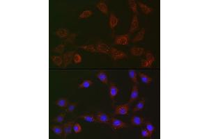 Immunofluorescence analysis of NIH/3T3 cells using [KO Validated] SQSTM1/p62 Rabbit mAb (ABIN7270205) at dilution of 1:50 (40x lens). (SQSTM1 antibody)
