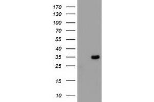 Western Blotting (WB) image for anti-Myeloid Differentiation Primary Response Gene (88) (MYD88) antibody (ABIN1499610) (MYD88 antibody)