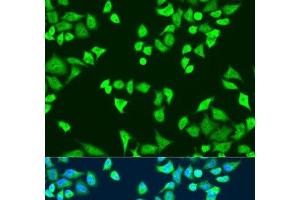 Immunofluorescence analysis of U2OS cells using SMN2 Polyclonal Antibody at dilution of 1:100.