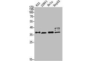 Western blot analysis of 823 22RV1 HELA HEPG2 Cell Lysate, antibody was diluted at 1:2000.